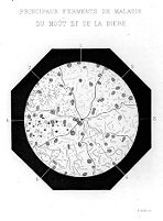 view M0015492: Micro-organisms found in beer which cause beer to turn