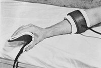 view M0015439: Application of short-wave diathermy employing condenser pads and cuffs