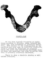 view M0015770: Photograph of a diseased lower jawbone from Krapina