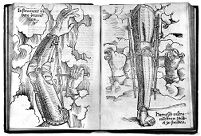 view M0015795: Instruments to treat contractions and straighten bent limbs, 1530