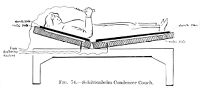 view M0015443: Illustration of the Schittenhelm condenser couch, introduced in 1911