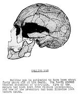 view M0015767: Drawing of a side view of the skull of Halling Man