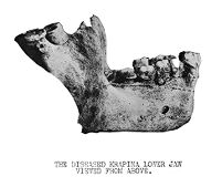 view M0015771: Side-view of a diseased lower jaw-bones of a skull from Krapina
