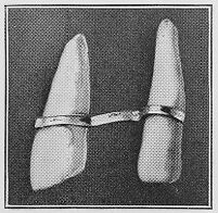view M0015704: Etruscan prosthetic appliance intended to avoid the bad effects of convergence, or, perhaps to support a purely ornamental artificial substitute