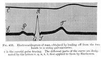view M0015496: Electrocardiogram obtained by Einthoven