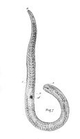 view M0016374: Illustration of an isolated nematode parasite, Trichinella spiralis