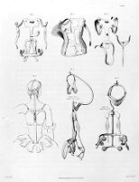 view M0016007: Engraving of John Shaw's apparatus for treating distorions of the spine and bones of the chest