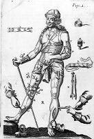 view M0016002: Illustration of orthropaedic apparatus and instruments