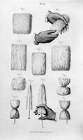 view M0016004: Dressings, from Goffres: <i>Bandages, pansements et appareils</i>, 1853