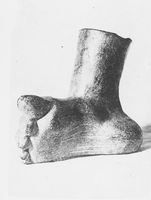view M0016584: Peruvian vessel in the form of a foot, possibly showing paralysis