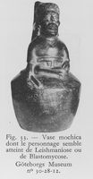 view M0016566: Peruvian pot in the form of a figure with either leishmaniasis or blastomycosis