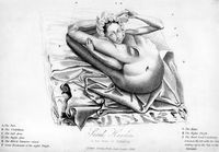 view M0017304: Portrait of Sarah Hawkes (fl.1832) prior to medical intervention