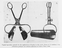 view M0017867: Illustration of a vaginal speculum suitable for the application of leeches to the cervix, 1826