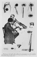 view M0017872: Illustration of Marion Sims repairing a vesico-vaginal fistula, 1870
