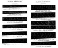 view M0019000: Pulse tracings from a sphygmograph, 1867