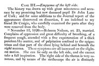 view M0019004EA: Excerpt describing the use of a stethoscope in Scotland, 12 November 1820