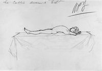 view M0019193: Illustration showing the compensatory curve in the spine when a limb is extended in cases of hip disease