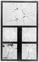 view M0019103: Appearance of optic disc using an ophthalmoscope, 1879