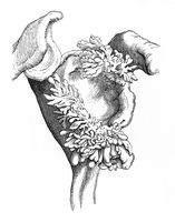 view M0019658EB: Illustration of lipoma arborescens of the shoulder joint, 1922