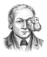 view M0019633: Illustration of an osteoma growing in the eye, 1917